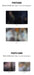 BLANK2Y - [Thumbs Up] Nolae Kpop